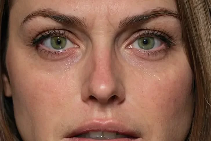 The truth behind grandma's fall